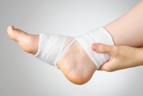 Ein Fuß einer Frau, der am Knöchel mit einer Bandage verbunden ist. 