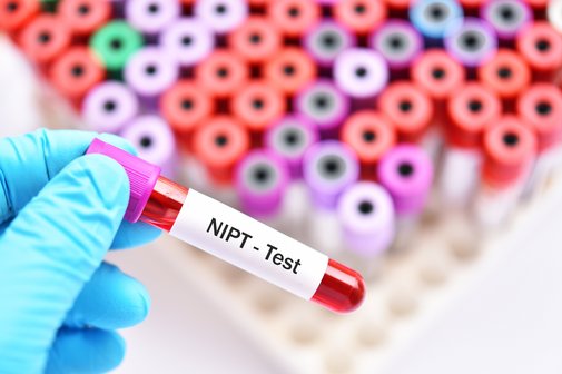 Eine Hand mit einem blauen Gummihandschuh hält ein Röhrchen mit einer Blutprobe, es ist mit "NIPT-Test" beschriftet. Im Hintergrund mehr Blutproben.